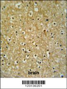 CIRH1A Antibody (N-term)