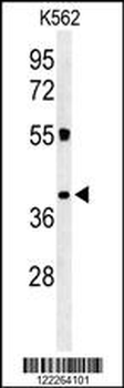 CLM1 Antibody (N-term)