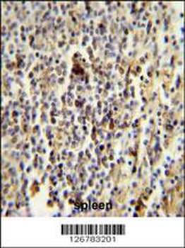 CD1E Antibody (Center)