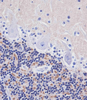 AMH Antibody (Center)