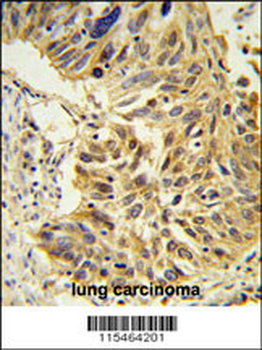 SDR Antibody (Center)