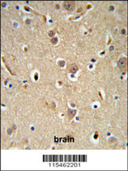 NEDD4 Antibody (C-term)