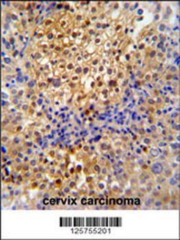 PR38A Antibody (C-term)