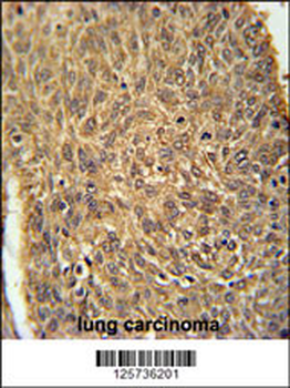 ATG13 Antibody (N-term)