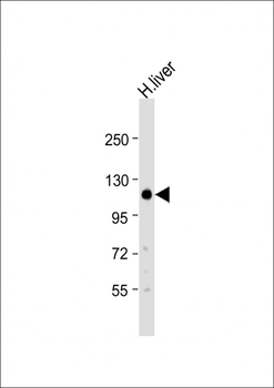 DEN1A Antibody (C-term)