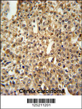 DEN1A Antibody (C-term)
