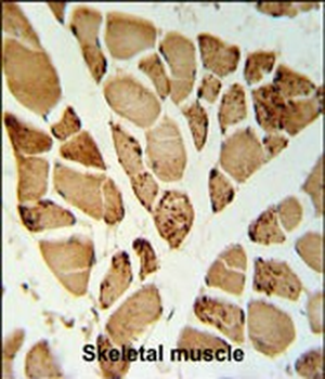 5NT1A Antibody (N-term)