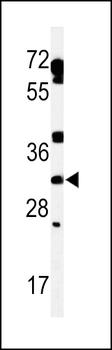 TBCD7 Antibody (Center)
