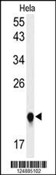 IMP3 Antibody (C-term)
