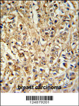 DDX6 Antibody (Center)