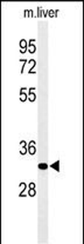 AIG1 Antibody (N-term)