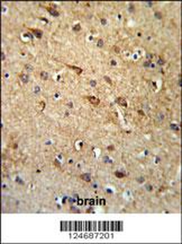 RGR Antibody (Center)