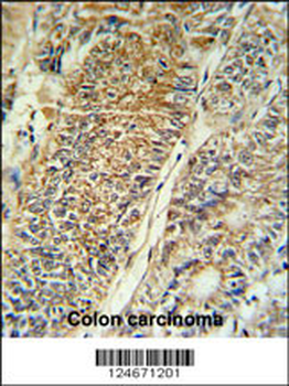 PYCR1 Antibody (C-term)