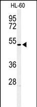 HOXA3 Antibody (C-term)