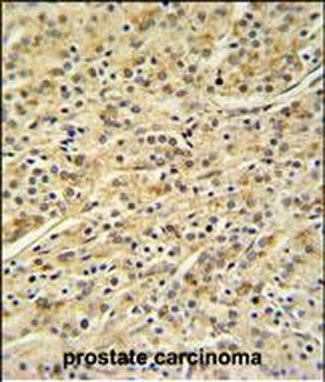 HOXA3 Antibody (C-term)
