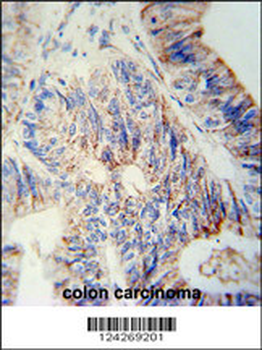 B3GNT6 Antibody (Center)