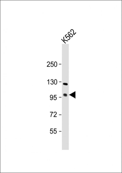 FOXK1 Antibody (C-term)