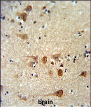 FASTKD2 Antibody (Center)