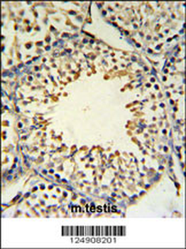 ACBG2 Antibody (Center)