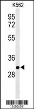 PGP Antibody (N-term)