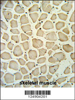 PGP Antibody (N-term)