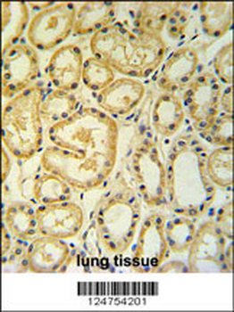 RT25 Antibody (C-term)