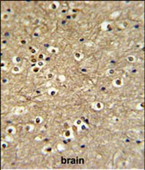 ETS2 Antibody (Center)