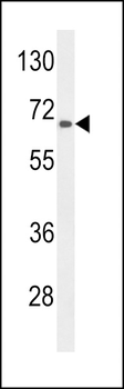 AGXT2 Antibody (C-term)