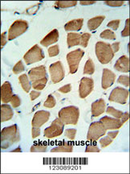 PDK2 Antibody