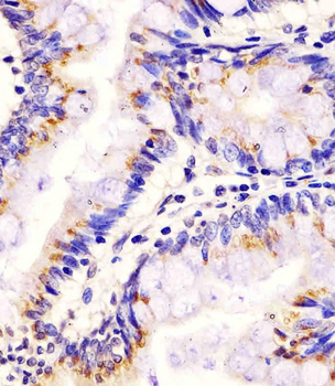 PLA2G7 Antibody (Center)