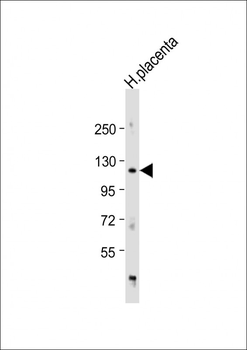 ADAM19 Antibody (Center)