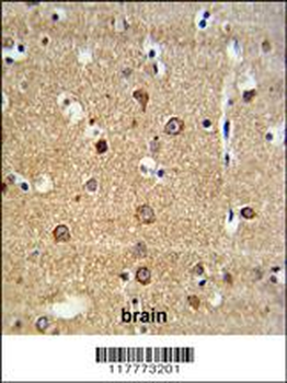 ADAM19 Antibody (Center)