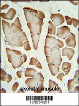 STX1A Antibody (N-term)