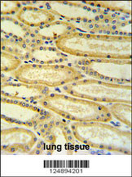 HSD17B11 Antibody (N-term)