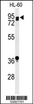 PATL1 Antibody (C-term)