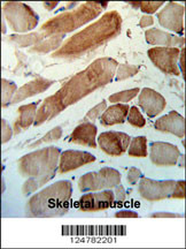 MMAA Antibody (N-term)