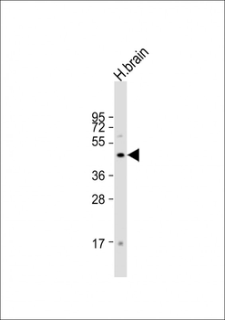 FOXG1 Antibody (Center)