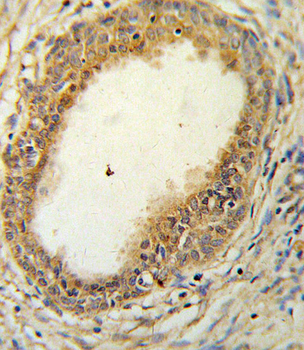 HAPLN1 Antibody (N-term)