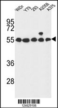 GPR180 Antibody (Center)