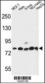 GPHN Antibody (Center)