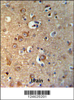 GPHN Antibody (Center)