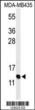GNRH2 Antibody (Center)