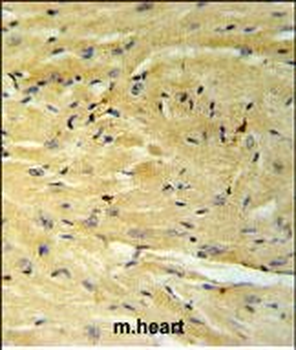 GNAT1 Antibody (C-term)