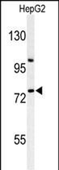 ZNF202 Antibody (Center)