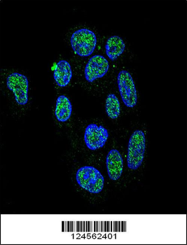 ZNF202 Antibody (Center)