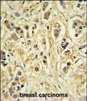ZNF202 Antibody (Center)