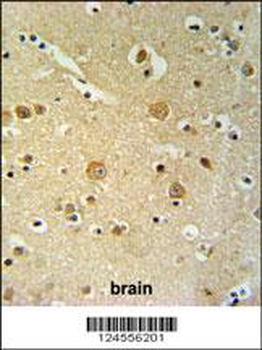 PKHH2 Antibody (C-term)