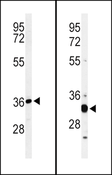 ST8SIA4 Antibody (Center)