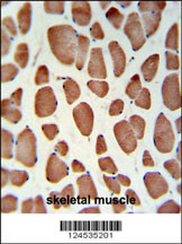 HSD11B2 Antibody (Center)