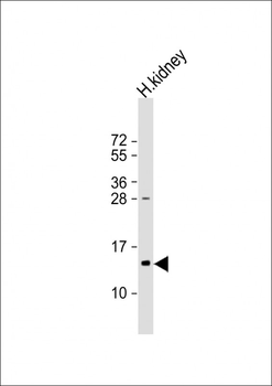 TMIE Antibody (Center)
